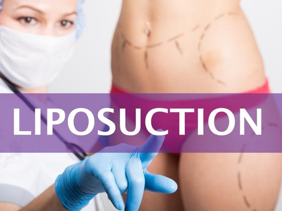 liposuction-near-Kompally-hyderabad